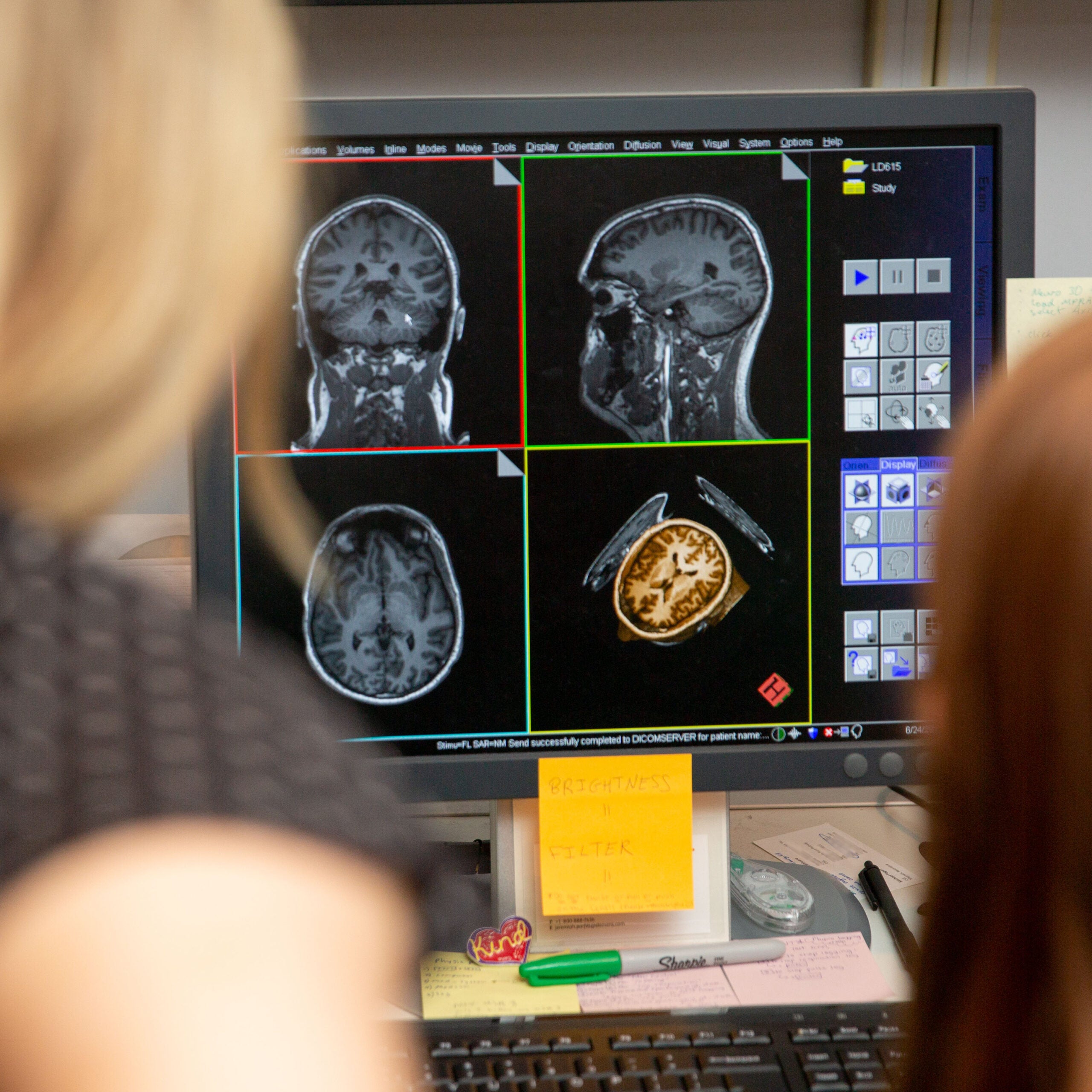 looking at brain scans