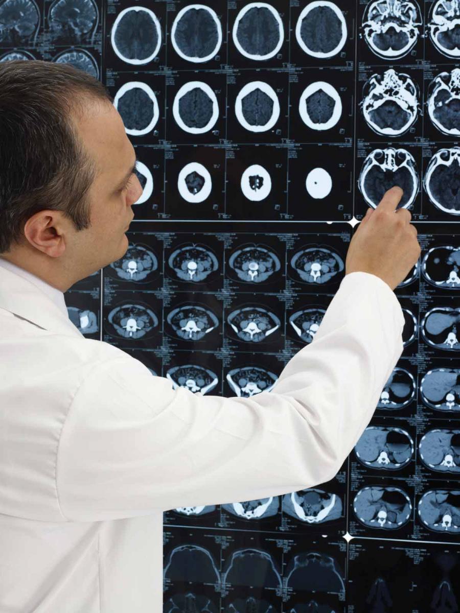 patient brain scans
